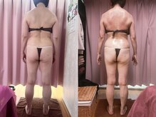 美容整体カラダリメイク(karada)/骨盤矯正ダイエットの結果