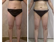 ルポーゼ(Repose)/