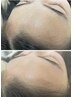 フェイシャルWAX【眉毛WAX込み】￥9500