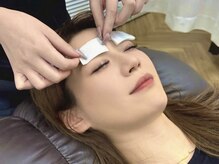 アイドット 名古屋駅前店(i.)/赤みを抑えるクールダウン