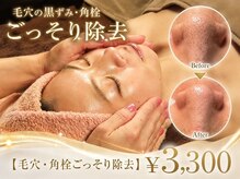 ノア(noa)