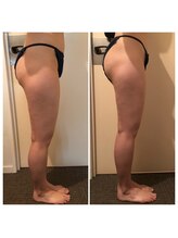 レナンセラ バイ カトレアグループ(Renanthera by カトレアGroup)/20代女性Before After