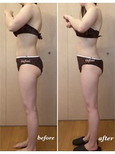 アンフィニ(infini)/短期集中全身コース5回（2ヶ月)