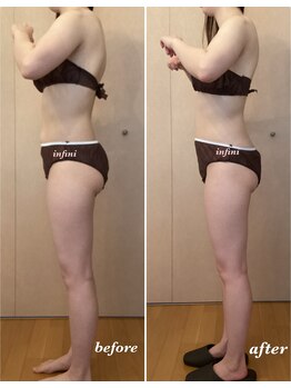 アンフィニ(infini)/短期集中全身コース5回(2ヶ月)