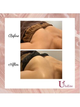 ウルエッテ(UluEtte)/バストのボリュームアップ/天神