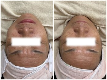 マヴィ くずは店(MavY.)/筋膜リリース!