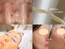 ドゥクス 難波店(Dux)の雰囲気（ニキビケア/美白/ホワイトニング/毛穴ケア/艶肌ワックス◎）