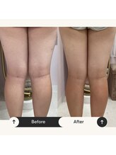 ユウキ(yuuki)/お客様の嬉しい結果！