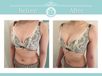 美人バスト 犬山店/【バストアップ★育乳】症例