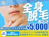 【メンズ脱毛】  全身脱毛（顔脱毛込/VIO脱毛込）＋フェイシャルマスク付