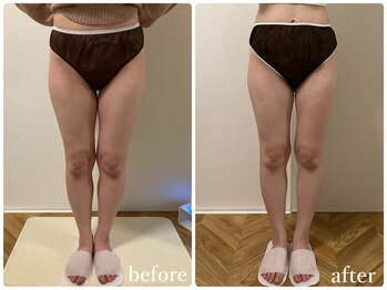 リリィブラン(Lily branc)/【痩身】ヒップ+太もも