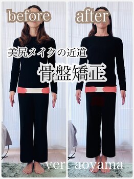 ヴェール 青山(vert)/骨盤矯正ビフォーアフター