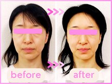 ホリハ整体院/*Before&After* 美顔デザイン
