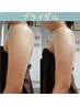 《ブライダル体験》　二の腕を引き締めたいならこれ！　120分