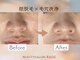 レイズ(RAISE)の写真