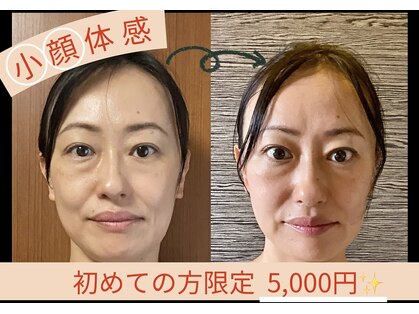 コライユ(corail)の写真