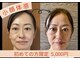 コライユ(corail)の写真