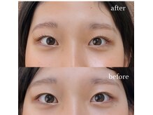 レコルトアイラッシュ(RECOLTE EYELASH)/まつ毛パーマ