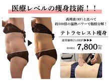 クレビア(Clevia)