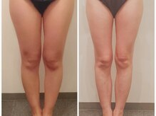 ニコルビー(Nicole Bee)/美脚