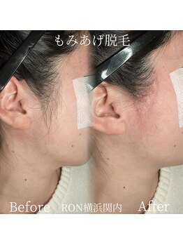 サロンロン 横浜関内(SALON RON)/