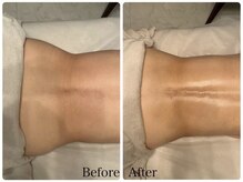 スターエステ(STAR ESTHE)/【ビフォーアフター】