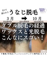 エリス(ELISSE)/うなじ脱毛