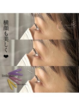 ニコ(Nico)/まつ毛パーマ/ラッシュリフト