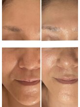 ブリジア(Brizzia)/高技術エイジングケア♪