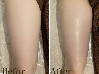 カレン(KAREN)/大人気セルゼロ+脂肪燃焼