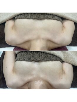 セレーネ(Selene)/バストアップ体験