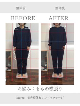 ヨギート(yogate)/整体/小顔/リンパマッサージ