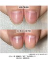 最強のネイルケア３ケ月間コース