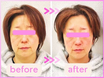 ホリハ整体院/*Before&After* 美顔デザイン