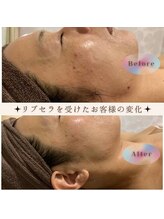 カピリナ(Kapilina)/全てのお肌のお悩みに♪