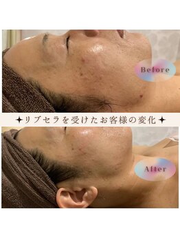 カピリナ(Kapilina)/全てのお肌のお悩みに♪