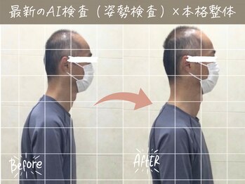 ナオル整体 町田院(NAORU整体)/before/after【1】 町田/整体