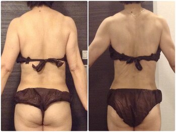 美容整体ウェリナ あま甚目寺院/小顔矯正/骨盤矯正/美脚サロン