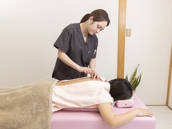 ぽぽらす鍼灸院 接骨院/施術風景(鍼灸)