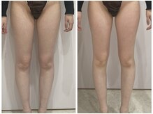 ルポーゼ(Repose)/