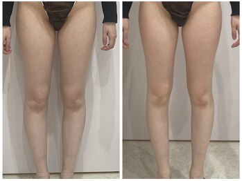 ルポーゼ(Repose)/