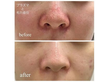 ミール(Meel)の写真
