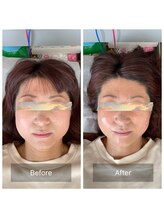 ハリ トモカ 南浦和サロン(HARI TOMOKA)/美容鍼