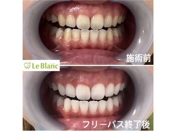 ルブラン 奈良店(Le Blanc)/駅近!土日祝も営業!