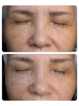 エクラ(eclat)/☆光フォトの効果☆