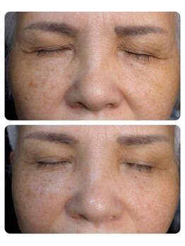 エクラ(eclat)/☆光フォトの効果☆