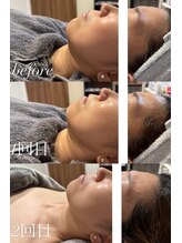 アイラッシュサロン ココ(CoCo)/ディレイアゼル2