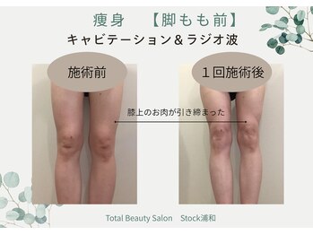 ストック 浦和(Stock)/痩身でひざくっきり