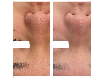 ボーテ デ ベル(Beaute de belle)の写真