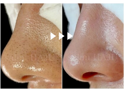 サロンハジュ(salon HAJU)の写真